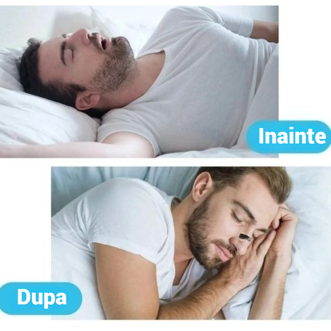 Kit 30 Benzi Nazale Anti-Sforait Extra-Forte - Respiratie Libera si Somn Odihnitor
